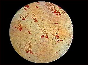 Organismo Salmonella typhi