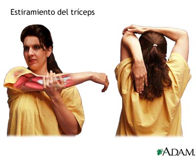 Estiramiento del tríceps