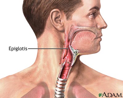 Epiglotis