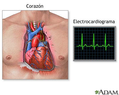 Electrocardiograma (ECG)