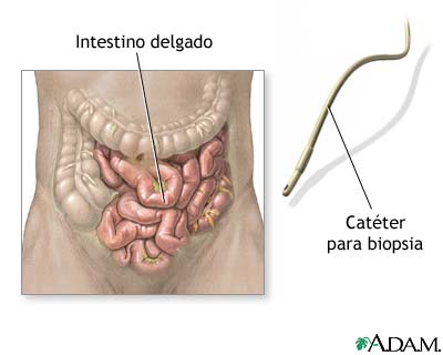 Biopsia del intestino delgado