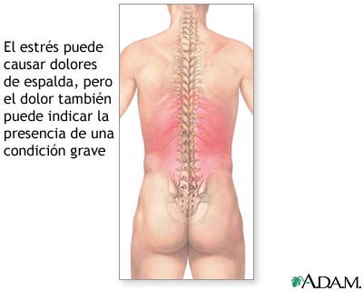 Dolor de espalda: MedlinePlus en español