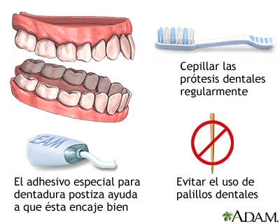 Cuidado de la dentadura postiza