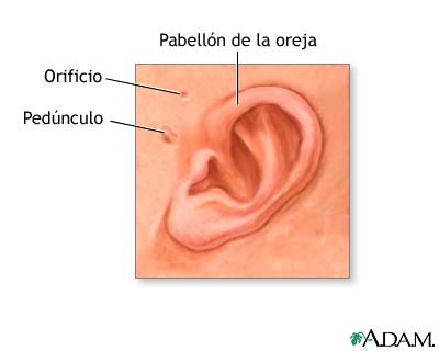 Anatomía de la oreja del recién nacido