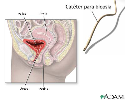 Biopsia ureteral