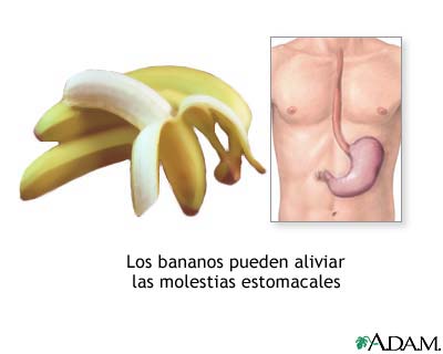 Bananas y náuseas