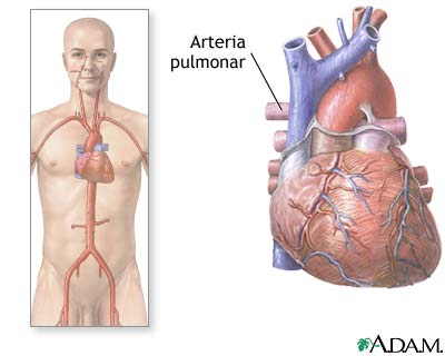 Arterias pulmonares