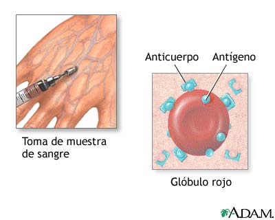 Biopsia de herpes