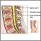 Cirugía de columna lumbar - Serie