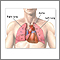 Trasplante de corazón y pulmón - Serie