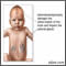 Adrenoleucodistrofia neonatal