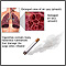 Hábito de fumar y EPOC (enfermedad pulmonar obstructiva crónica)