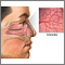 Hemorragia nasal