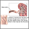 Arterias renales