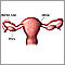 Anatomía uterina